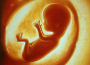 Overpopulation doesn't justify abortion